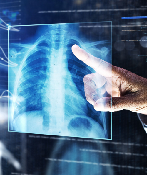 X ray hand L2S